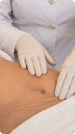 Tratamento para Flacidez feito pela Alciara Lima dermatologista de alta qualidade