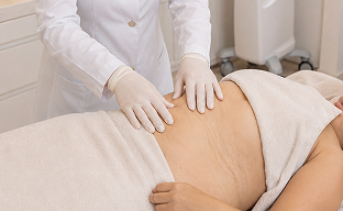 Alciara Lima Dermatologista fazendo Tratamento para Flacidez em uma paciente